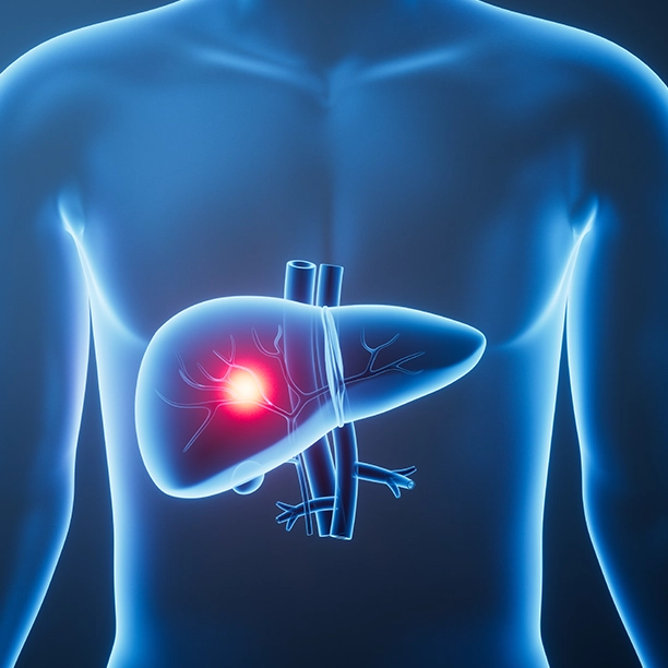 Hepatitis Treatment